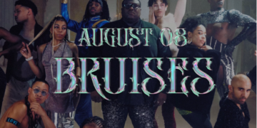 August 08 Bruises